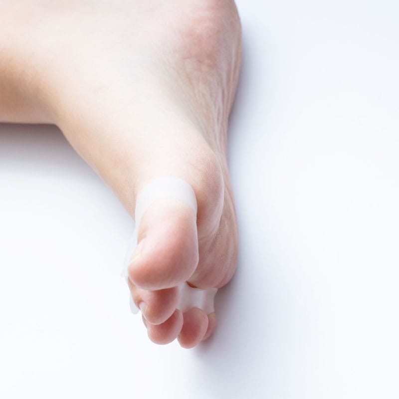 Écarteur d'orteils pour hallux valgus – Image 4